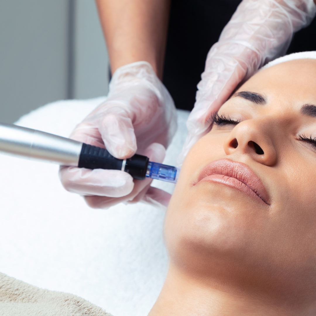 Microneedling and basic facial